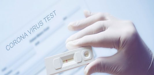 Kerja Sama dengan Dompet Dhuafa, Lion Air Tambah 5 Lokasi Rapid Test