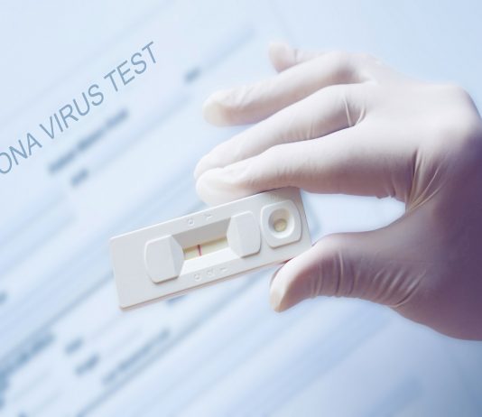 Kerja Sama dengan Dompet Dhuafa, Lion Air Tambah 5 Lokasi Rapid Test