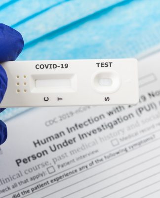 AirAsia Sediakan Layanan Rapid Test Drive-thru di Bandara Soetta